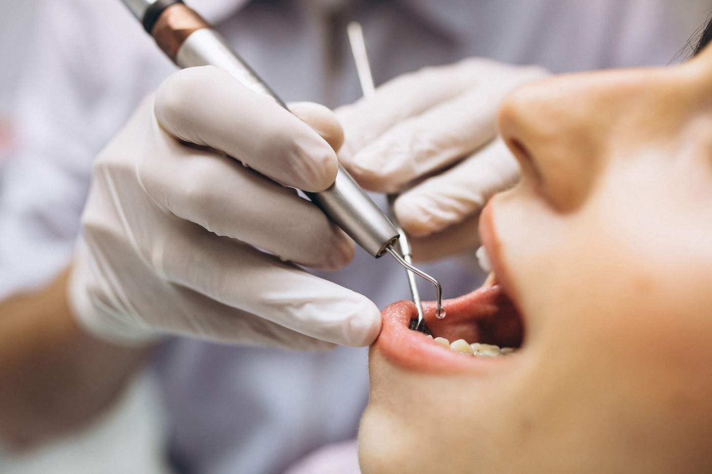 Clínica de la Universidad Latina ofrece tratamientos dentales más baratos