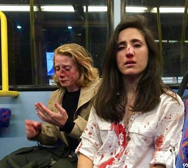 Dos mujeres atacadas en un autobús en Londres por “lesbianas”