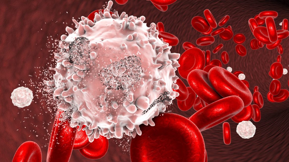 Terapia celular “de última línea” podría aplicarse a niños ticos con leucemia el próximo año