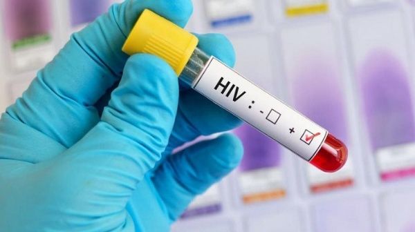 Aprobada actualización de Ley de VIH-SIDA: prueba será obligatoria para embarazadas y migrantes podrán recibir atención