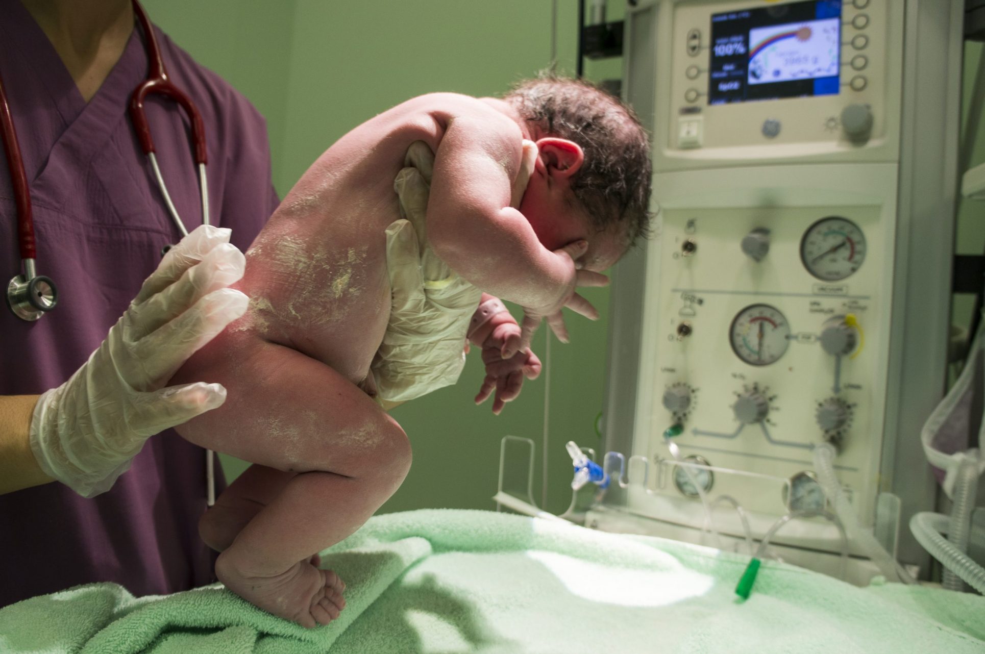 Bebé de 5 días de nacido está en cuidados intensivos contagiado con COVID-19