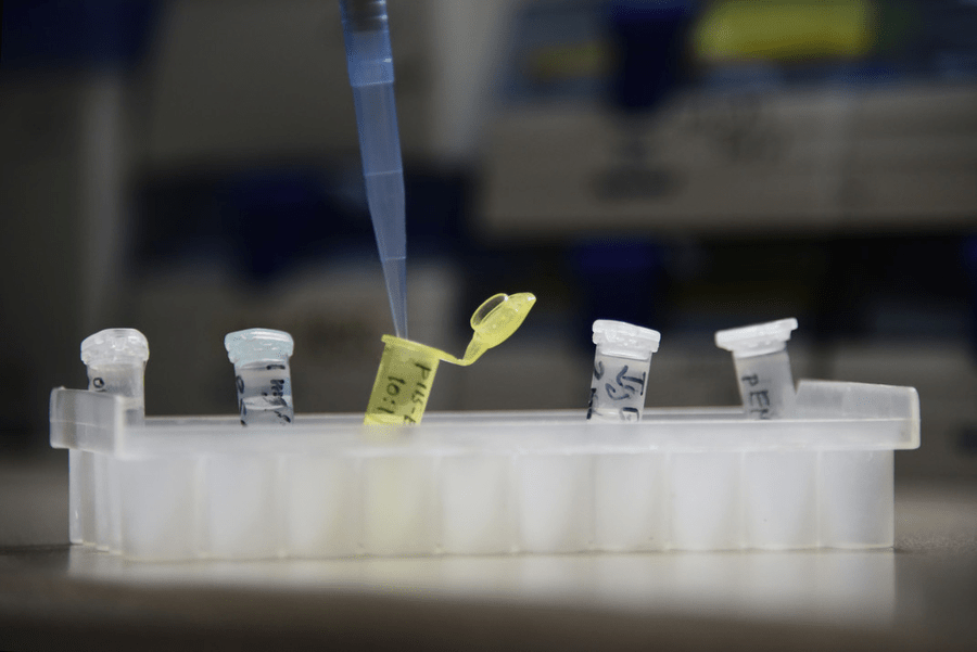 CCSS y UCR harán nuevo estudio de suero anticovid con 156 pacientes