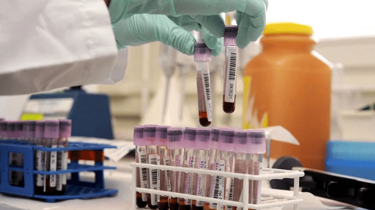 Ministerio de Salud autoriza uso de pruebas para detectar anticuerpos de COVID-19