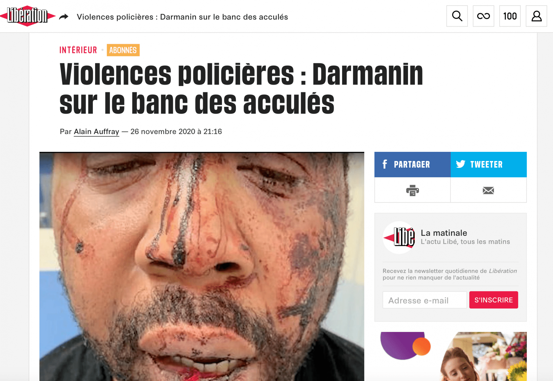 Brutal paliza a un hombre en Francia porque no llevaba mascarilla