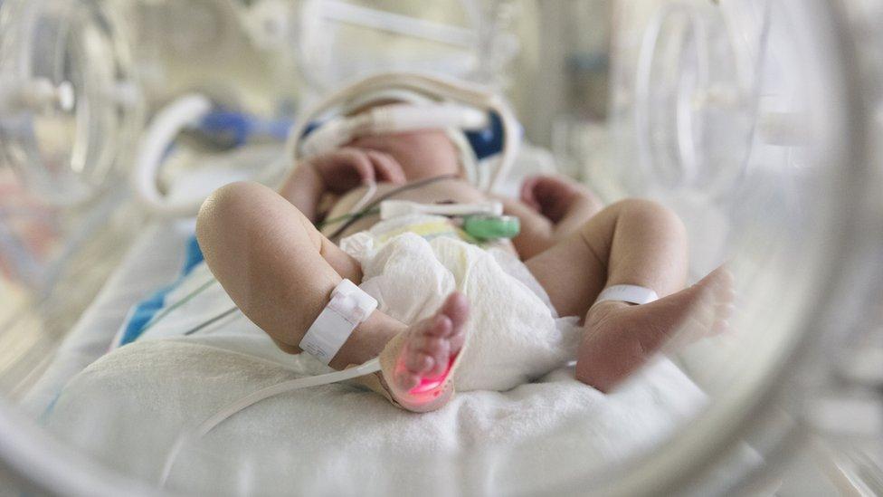 Por qué mueren 10 veces más bebés por covid en Brasil que en EE.UU.