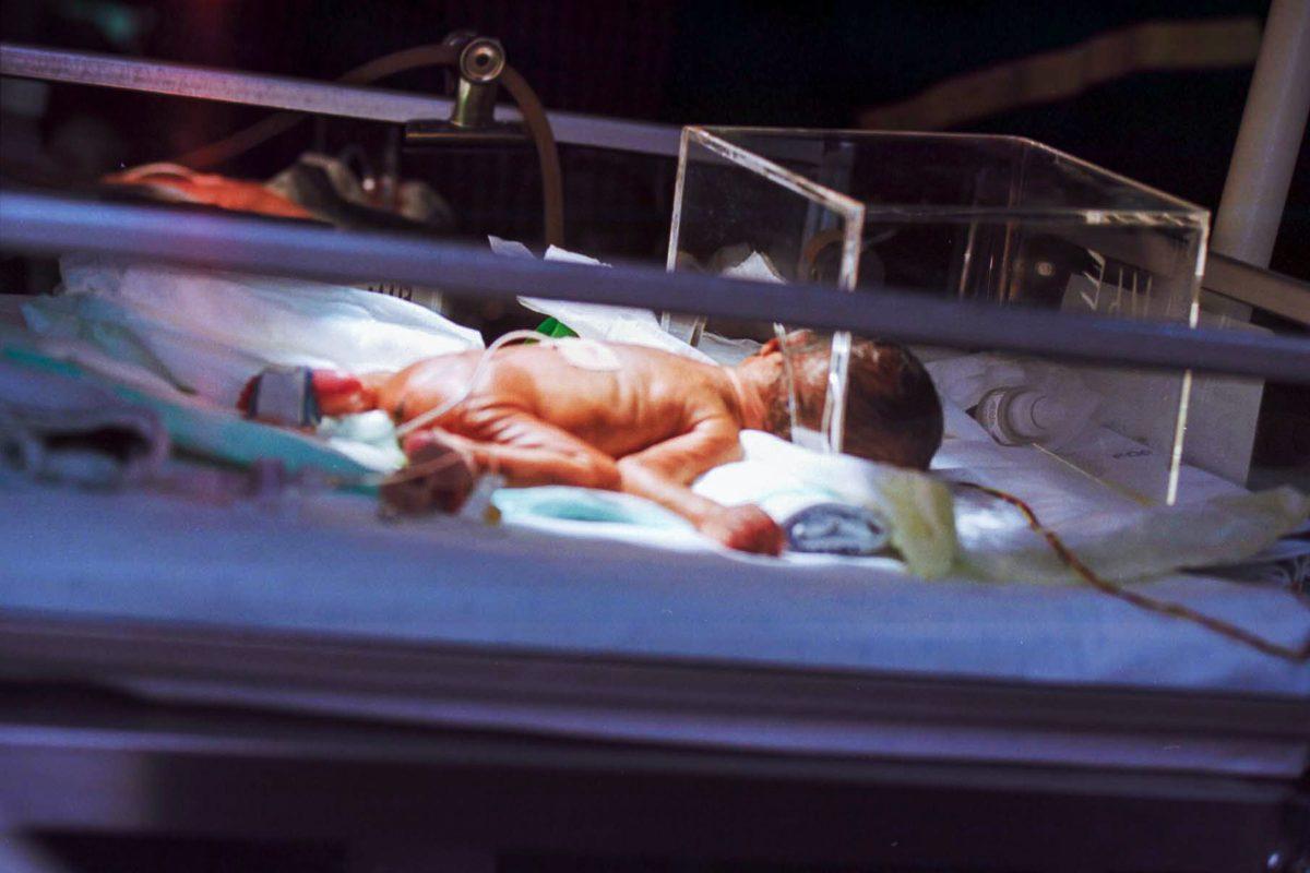 30% de las muertes infantiles en Costa Rica son por causa de prematuridad extrema