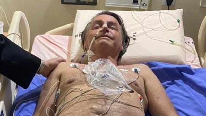 Jair Bolsonaro, presidente de Brasil, es hospitalizado tras sufrir un hipo crónico