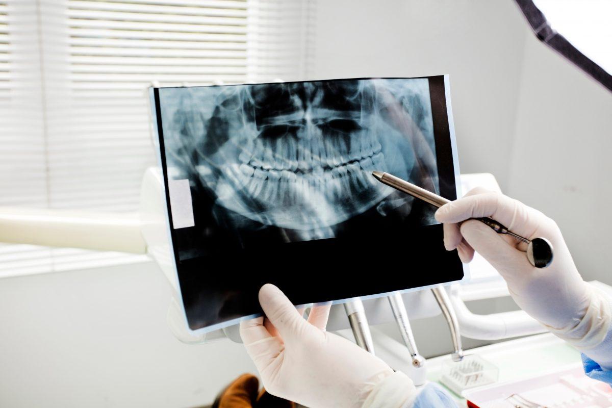 Todo esto y más puede descubrir de su salud dental a través de una radiografía