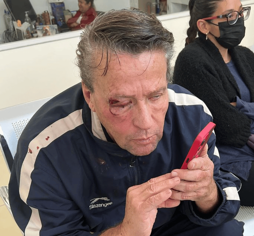 Actor mexicano Alfredo Adame protagoniza nueva pelea callejera; recibe siete puntos de sutura en la cara