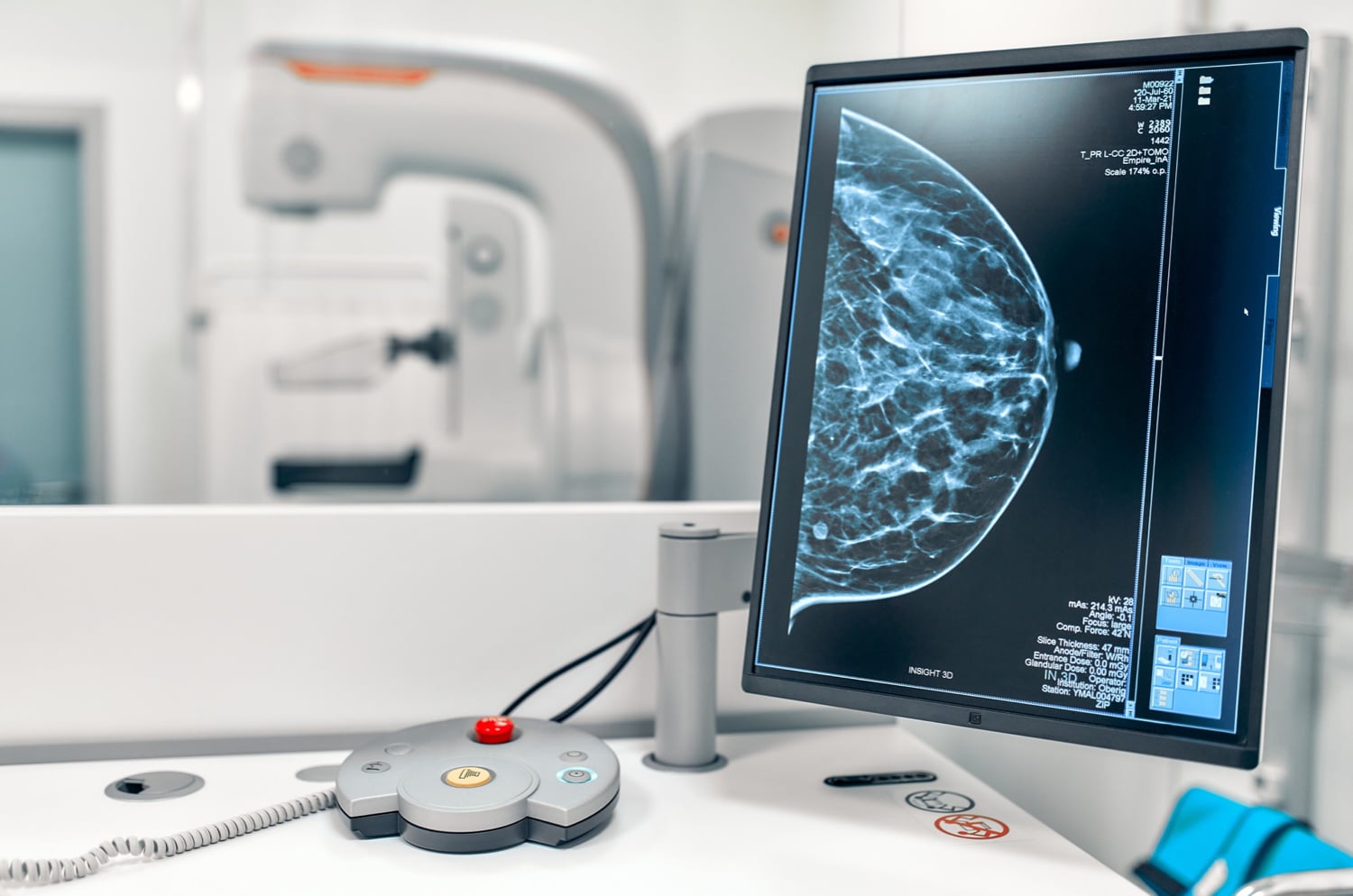 Ofrecen ¢7.000 a radiólogos por cada reporte de mamografía que contrató la CCSS a empresa privada