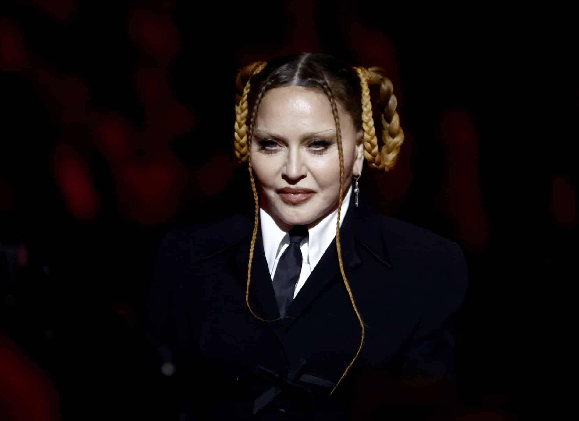 Madonna en los Grammy: ¿qué le pasó en la cara a la artista? Esto dicen medios y especialistas