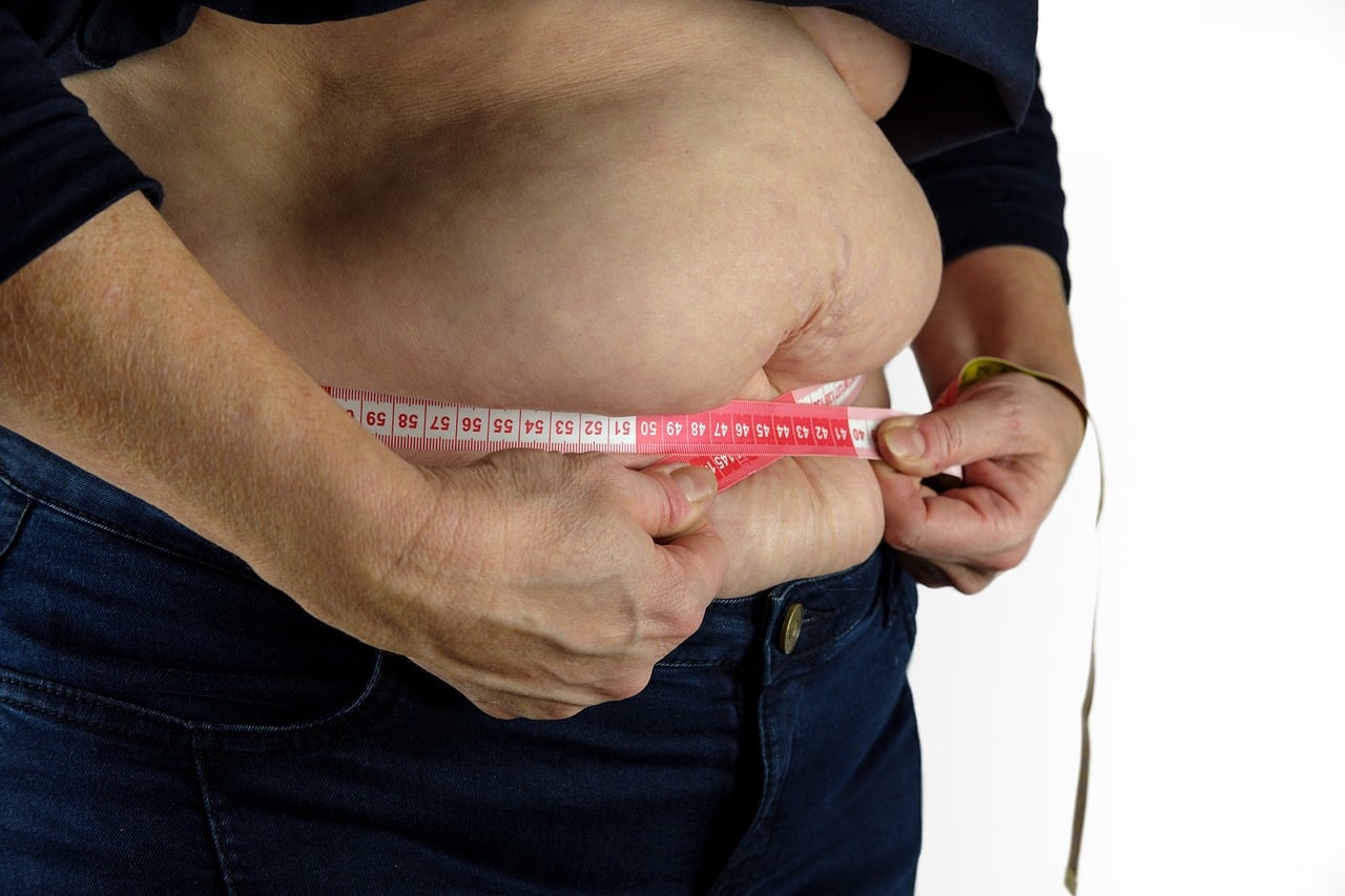Pronósticos apuntan a que 50% de los ticos serán obesos o tendrán sobrepeso en 2035; incremento anual es mayor en niños