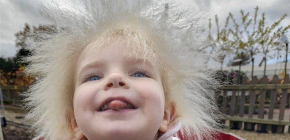 “El pelo de mi hija es hermoso”: qué es el síndrome del cabello impeinable causado por una mutación genética